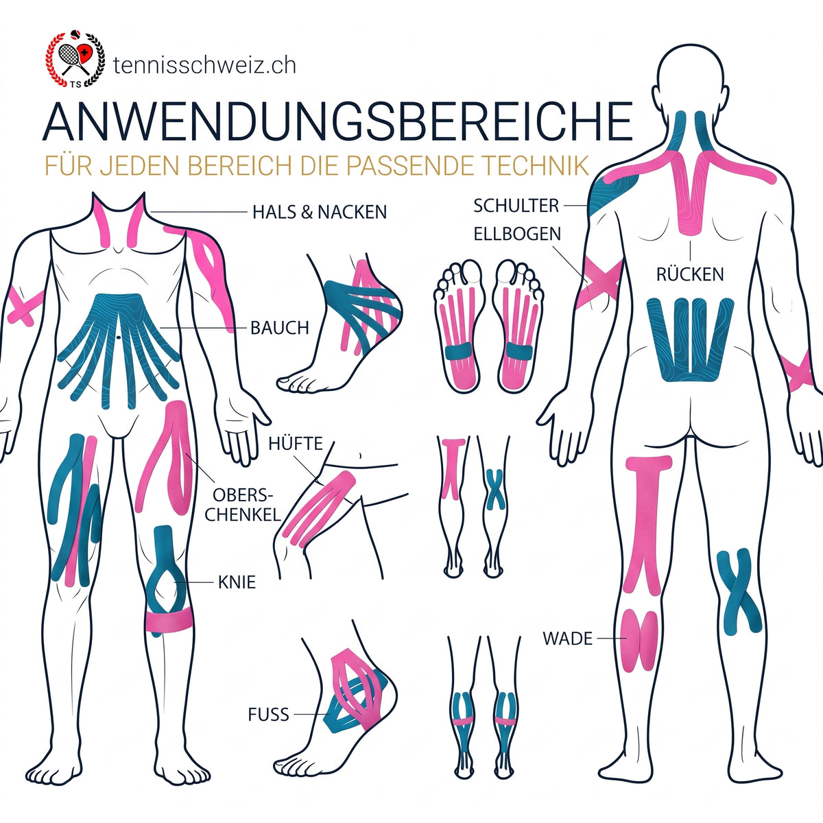 Übersicht der Taping-Techniken und Anwendungsbereiche für Kinesiologie-Tape von tennisschweiz.ch an Nacken, Schulter, Rücken, Knie, Wade und Fuss.